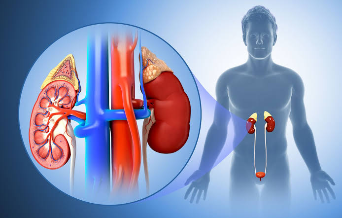 Kidney Failure